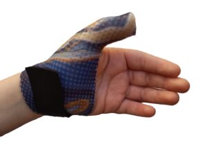 Attelle statique thermoformée - Entorse du skieur