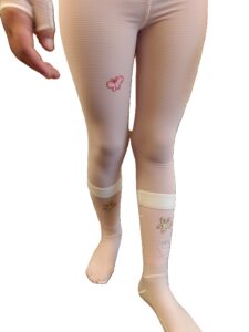 Ehlers-Danlos pantalon et chaussette compressif pédiatrie S.E.D