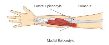 image myologie coude épitrochléite
