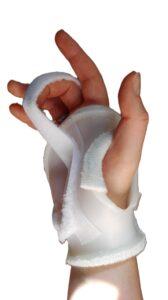 Attelle dynamique - Raideur articulations interphalangiennes proximale et distale