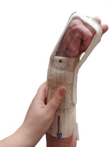 Vérification amplitude poignet avant et après moulage