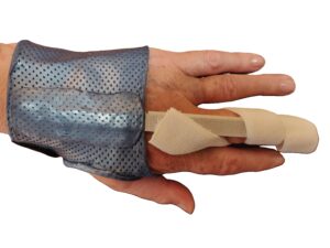 attelle de main dynamique lame de levâme maladie de dupuytren