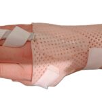 Attelle de main post-opératoire maladie de Dupuytren