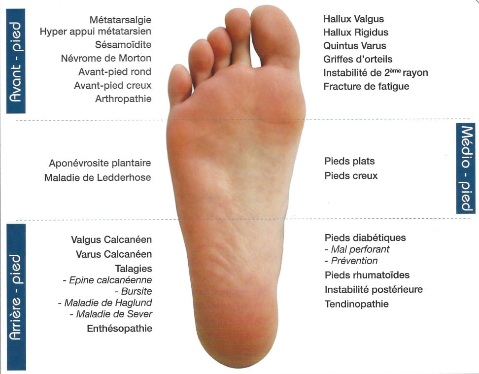description pathologies orthopédiques du pied